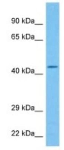 LAP1B Rabbit anti-Human, Polyclonal, Novus Biologicals 100 &mu;g; Unconjugated:Antibodies,